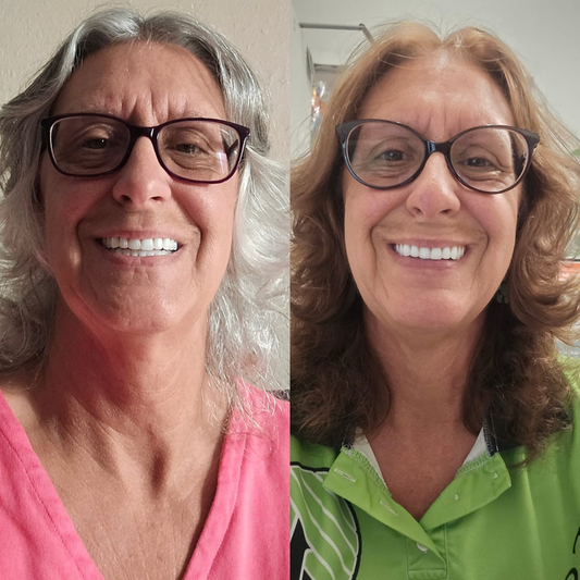 cheveux-blanc-apres-40ans 